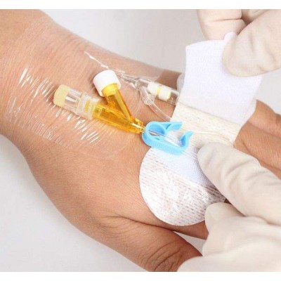 留置针贴固定法